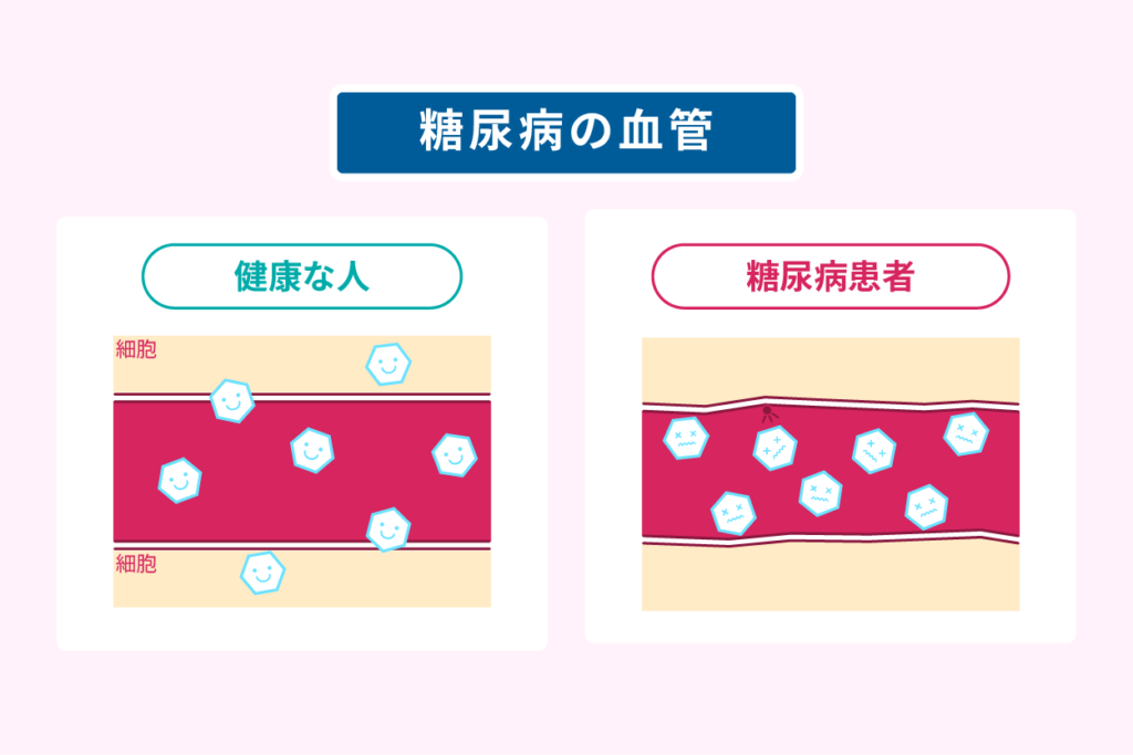 糖尿病の血管